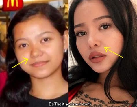 bella poarch before surgery|Bella Poarch in 2024: Transformation Before Surgery Revealed